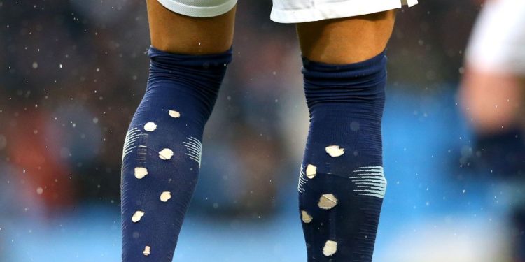 Mengapa pesepak bola sekarang melubangi kaus kakinya dan apa alasannya?